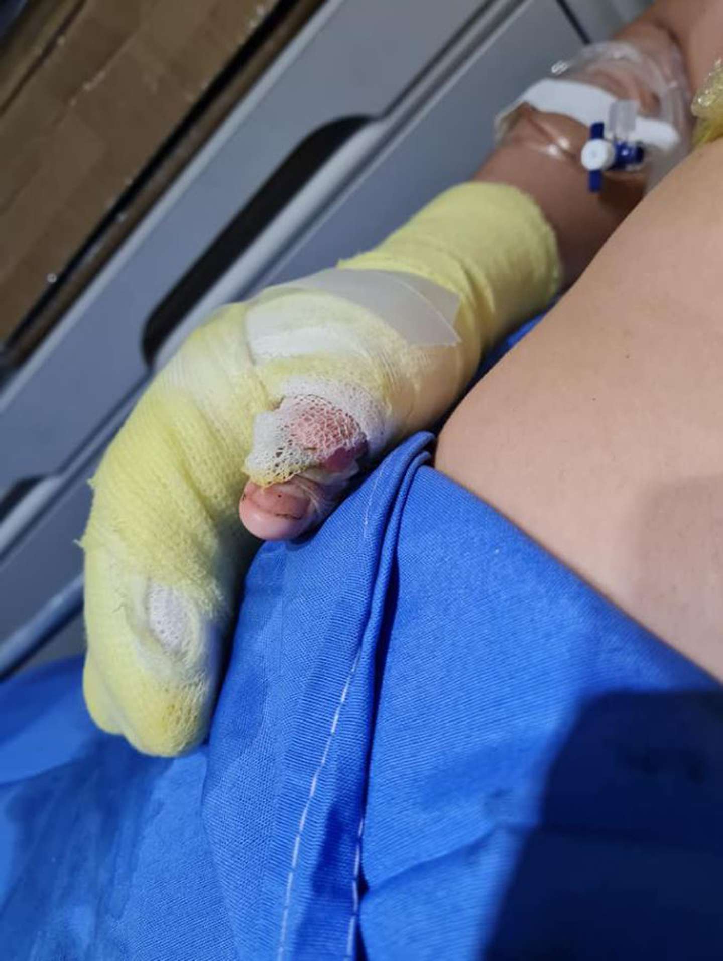 Laferrere – Feria de ciencias: La explosión de un experimento hirió de gravedad a un estudiante