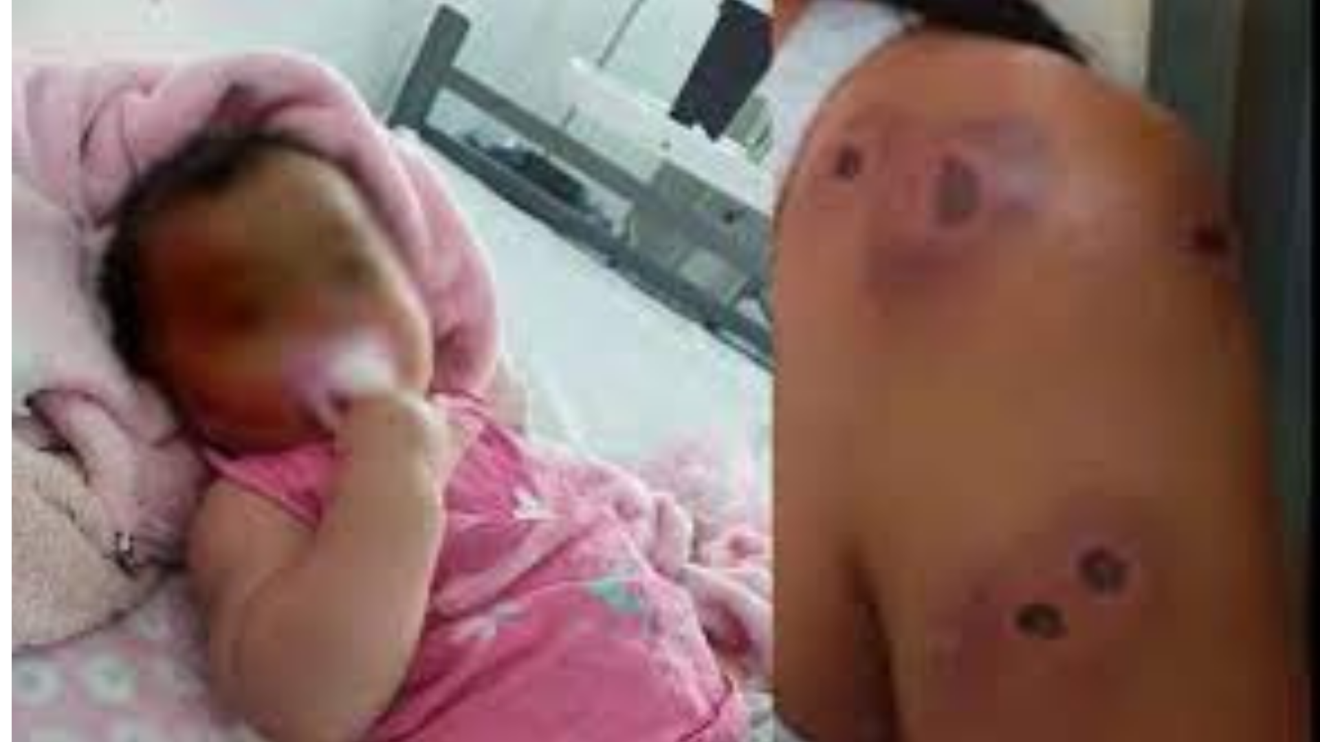 UNA BEBA RECIBIÓ UNA PERDIGONADA DURANTE UN PROCEDIMIENTO POLICIAL EN MERLO