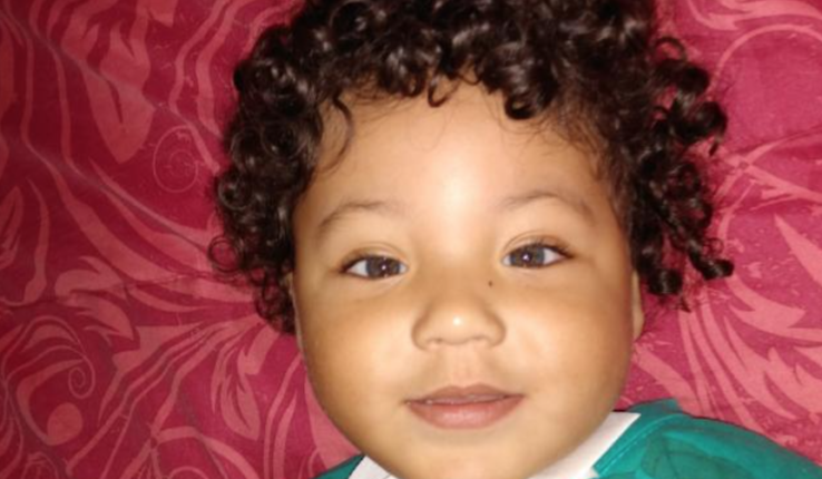 Erick Síndrome Pura