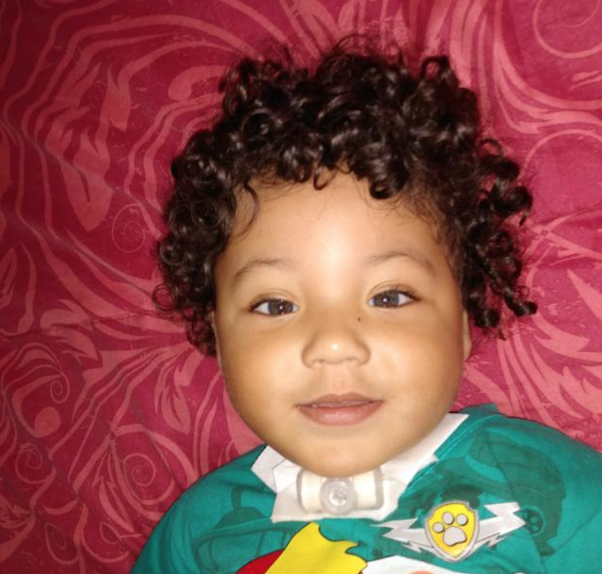 Erick Síndrome Pura