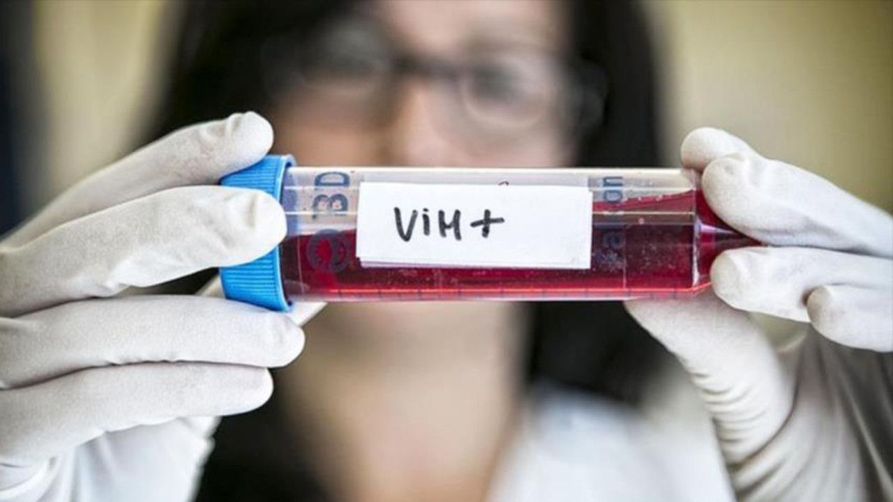 Descubrimiento sobre VIH: Científicos argentinos avanzan sobre una posible cura
