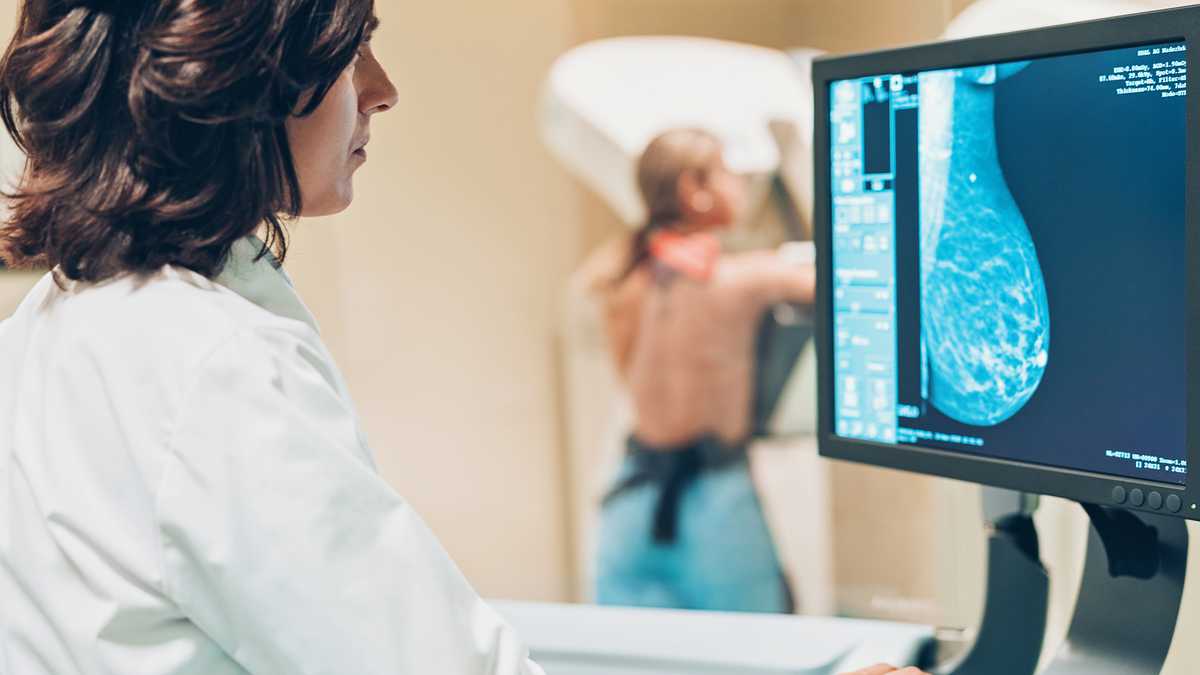 Noche de las Mamografías: ¿Qué es y qué hospitales participan en La Matanza?