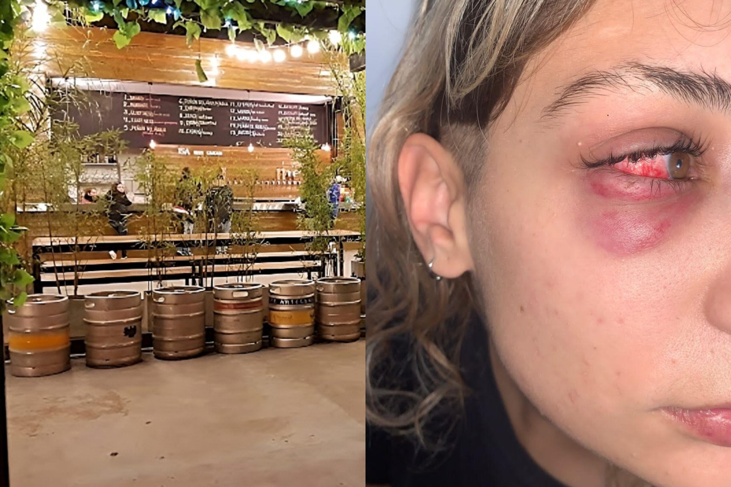 Ramos Mejía: Denuncian que un boliche expulsó a la calle a una joven golpeada y sangrando