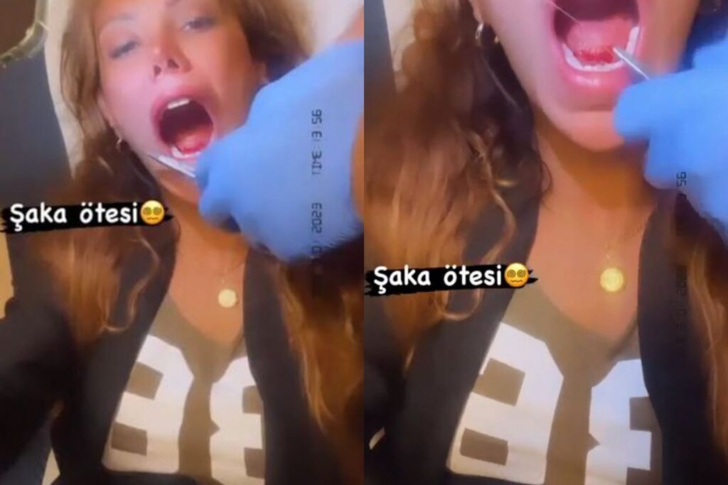 Beso Lengua Modelo Turca