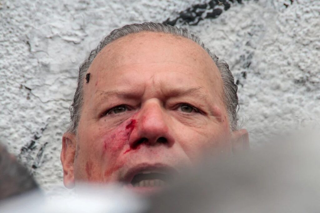 Berni Parte Médico Golpiza