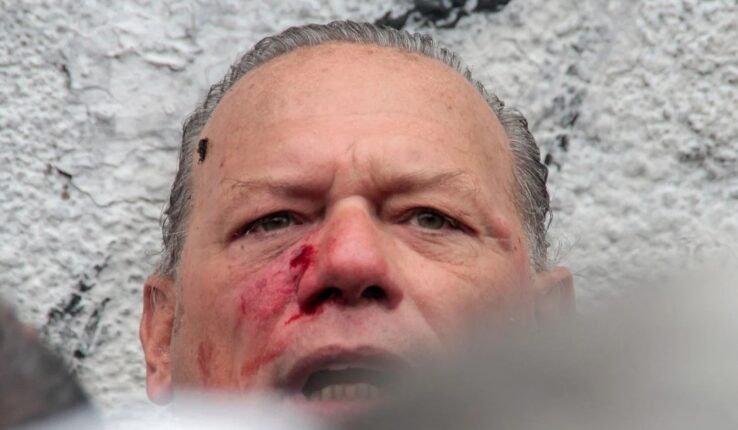 Berni Parte Médico Golpiza