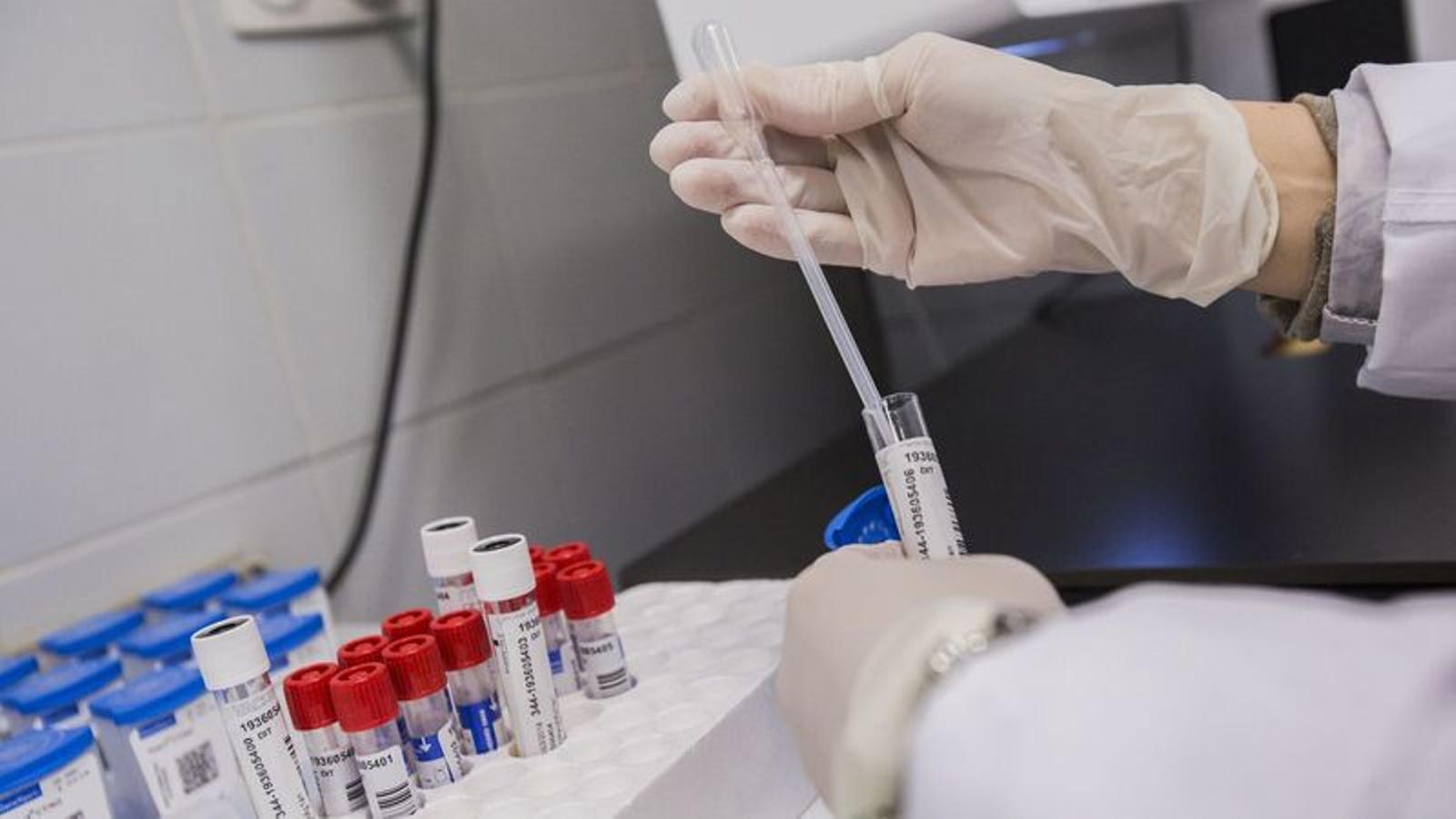 La ONU aseguró que todavía es posible alcanzar “el fin del sida” antes de 2030